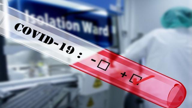 Bertambah 23 Orang Total Positif Covid-19 di Riau 150.190 Kasus