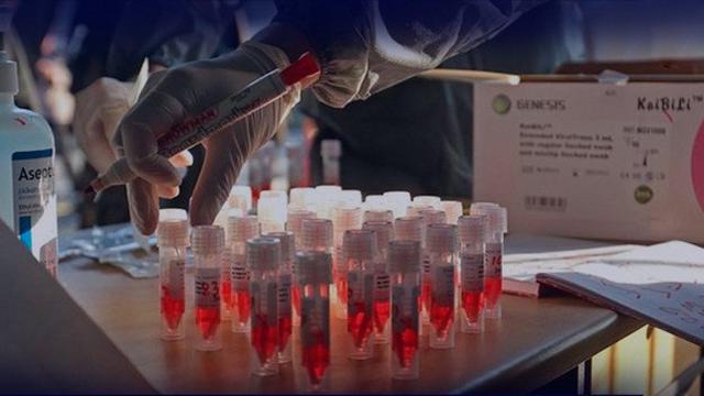 Sudah 871.436 Spesimen Diperiksa Terkait Covid-19