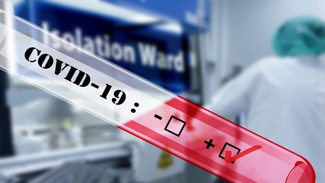 Per Hari ini 893 orang dinyatakan positif COVID-19 di Indonesia