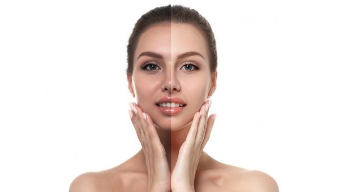 5 Cara Ini Dapat Putihkan Kulit Mu Dengan Cepat