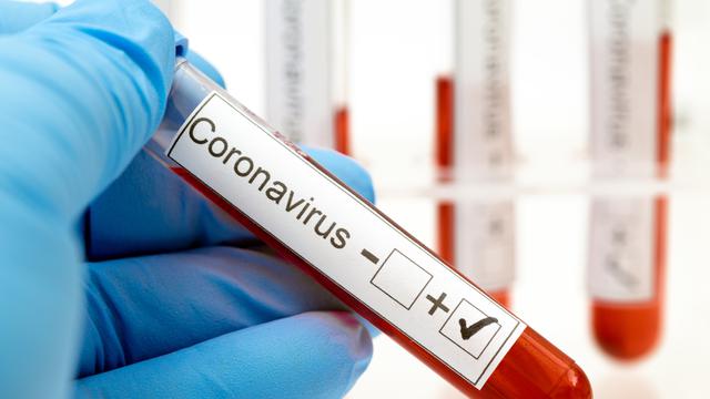 Pimpinan BRK Terkonfirmasi Covid-19, Hari Ini Seluruh Karyawan Jalani Swab