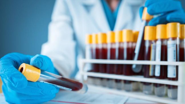 Tidak ada Prioritas Bagi Pejabat di Korsel Untuk Melakukan Test Corona