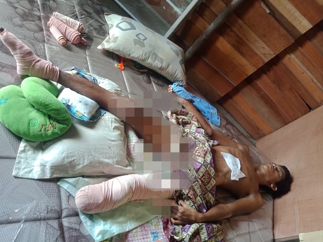 Kapolsek Tambang Bantu Warga Desa Kualu Korban Kecelakaan