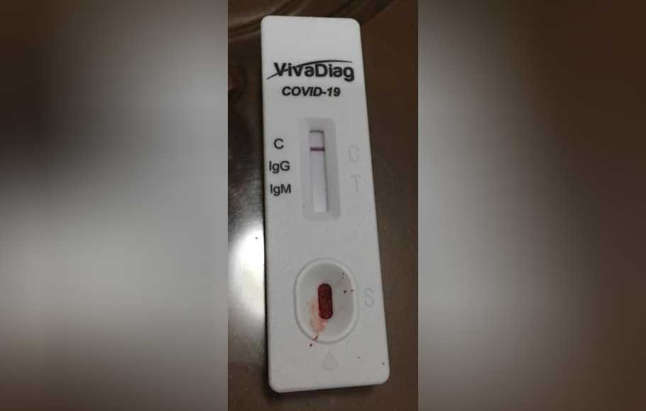 Rapid Test Covid-19 Digelar Hari Ini, Target Pertama Tenaga Medis 