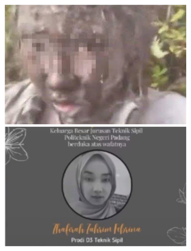 Sempat Dirawat, Korban Erupsi Gunung Marapi Ife Meninggal Dunia