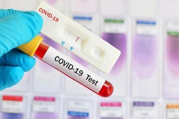 Hingga Juli, 51.755 Warga Riau Sudah Di Rapid TestÂ 