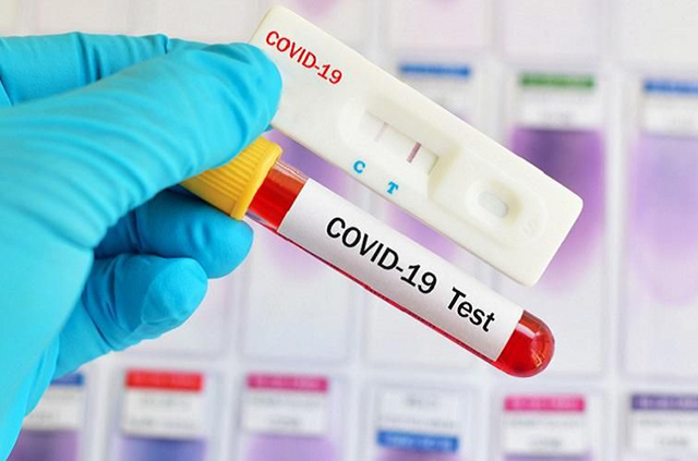 Kemenkes Tetapkan Tarif Maksimal Rapid Test Corona Rp 150 Ribu