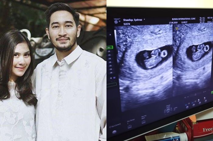 Syahnaz Sadiqah Syok saat Tahu Hamil Anak Kembar