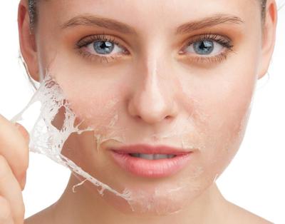 5 Cara Atasi Kulit Wajah Kering