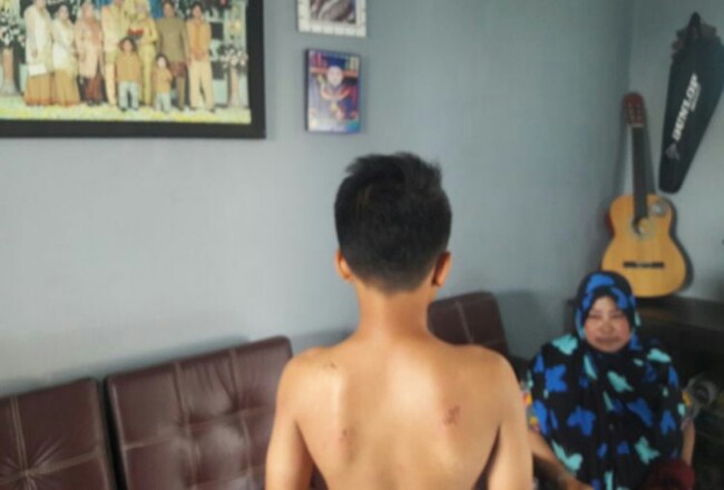 Empat Siswa Disengat Tawon, 1 Tewas, Begini Kronologisnya