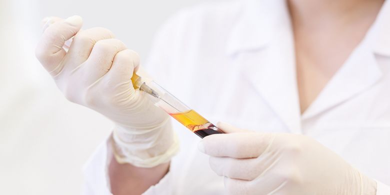 Begini Syarat Pendonor untuk Terapi Plasma Darah Covid-19