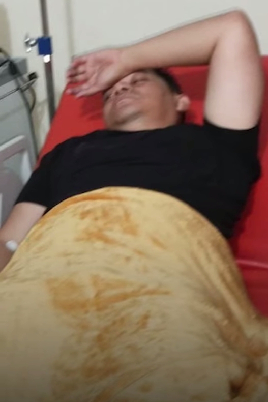 Wakapolres Kuansing Diserempet Motor Saat Razia Balap Liar, Cedera Serius di Kaki