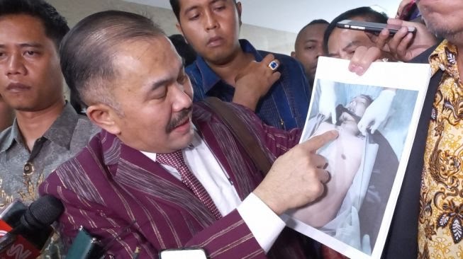 Keluarga Temukan Bukti Luka Jerat di Leher Brigadir J