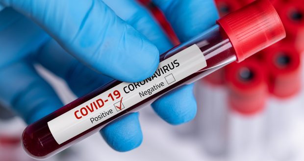 361 WNA di Indonesia Positif Covid-19, 30 Orang Meninggal