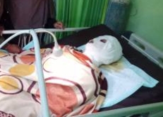 Tragis! Tubuh Pekerja PKS di Inhu Melepuh Akibat Air Rebusan Sawit