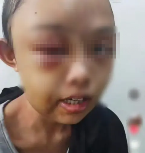 Viral di Medsos, Gadis Muda di Kampar Dianiaya oleh Tantenya