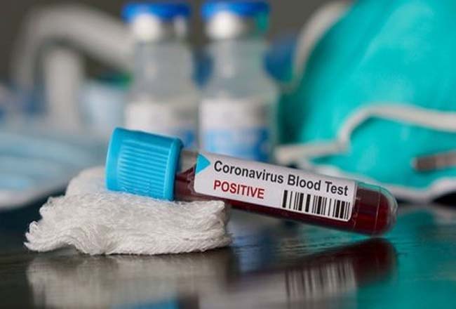 WNI Positif Corona di Luar Negeri Jadi 406 Orang: 95 Sembuh, 19 Meninggal 