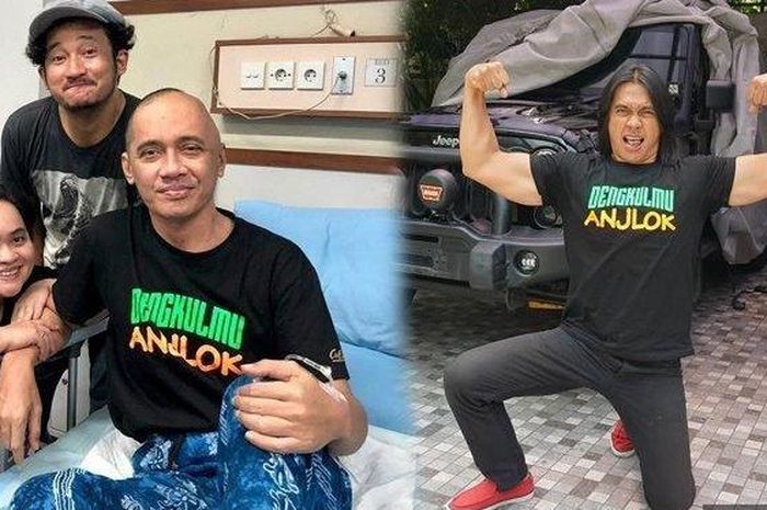Agung Hercules Menyerah pada Kanker, Tutup Usia di Umur 51 Tahun