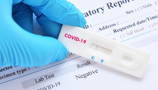 Sering Dianggap Tak Akurat, Pemerintah Bakal Cari Pengganti Rapid Test