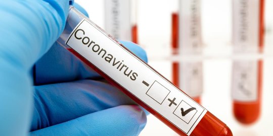 Kasus Covid-19 di Riau Hari Ini Turun Lagi, Sembuh 73 Orang