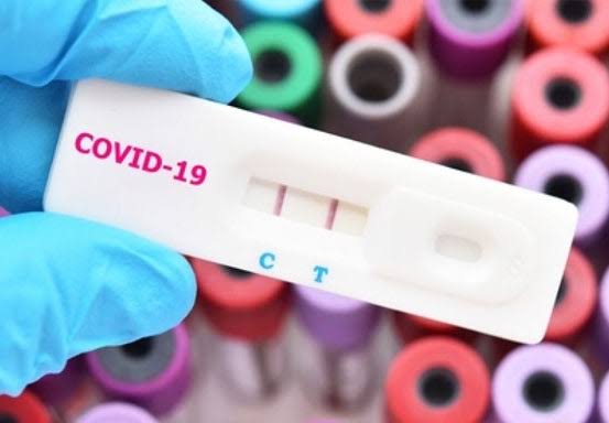 Warga Kelurahan Sialang Munggu Mulai Rapid Test Masal