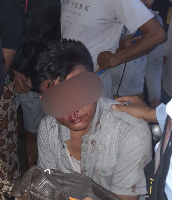 Diduga Kabur Usai Tabrak Sepeda Motor, Oknum Jaksa di Riau Dihajar Massa