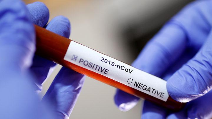 Sabtu Pagi, Total 259 Korban Meninggal Akibat Virus Corona