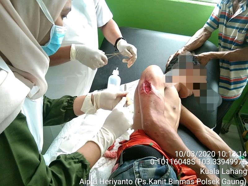 Hendak Menjala Udang Warga Gaung Diterkam Buaya