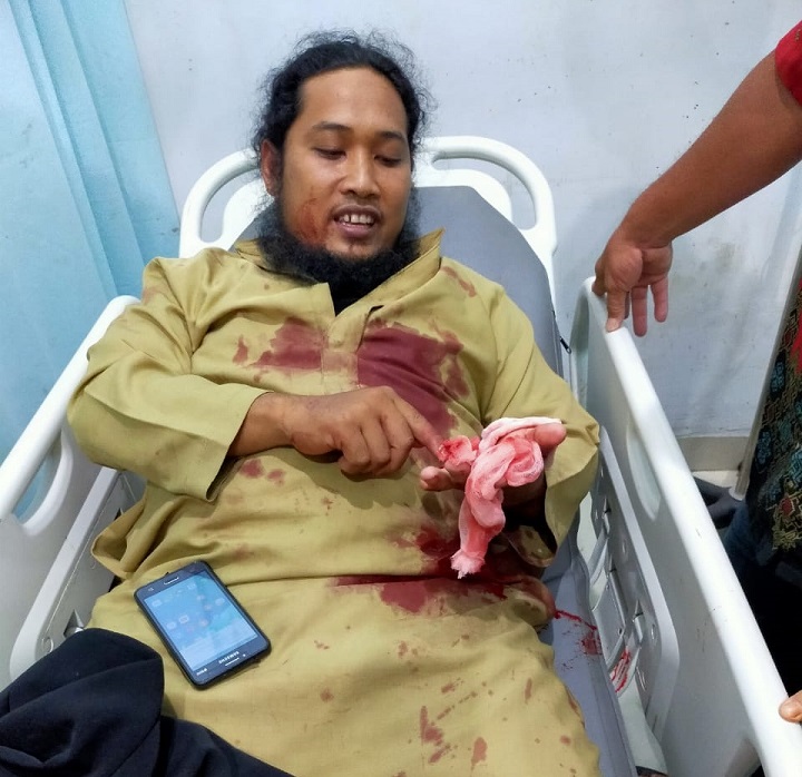 Ustaz di Aceh Ditusuk saat Beri Ceramah Peringatan Maulid Nabi 
