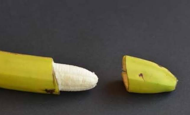 Kasihan, Penis Bocah di Cerenti Terpotong Saat Ikut Khitanan Massal