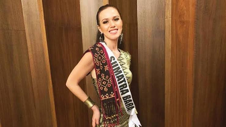 Dibully Netizen, Ini Penjelasan Putri Sumbar Kallista Iskandar