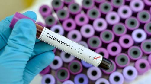 Tertular Dari Saudara Sepupu, Anggota Satpol PP Pekanbaru Positif Covid -19