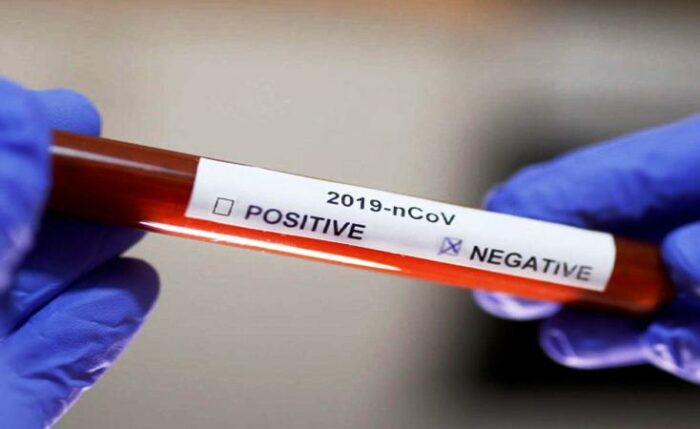 Persentase Pasien Sembuh dari Covid-19 di RI Capai Angka 80,5 Persen 