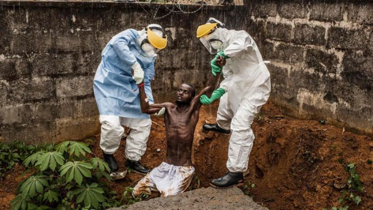 COVID-19 Belum Usai, Kongo Umumkan Kasus Baru Ebola
