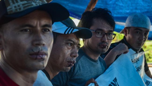 Kesal Aksi Protes Tak Direspon, 4 Pengungsi Afghanistan di Pekanbaru Jahit Mulut