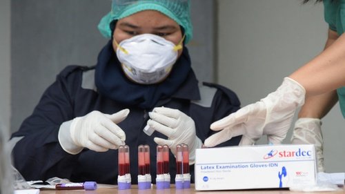 Gugus Tugas Riau Tak Percaya Rapid Test Corona karena Banyak Hasil Negatif Palsu