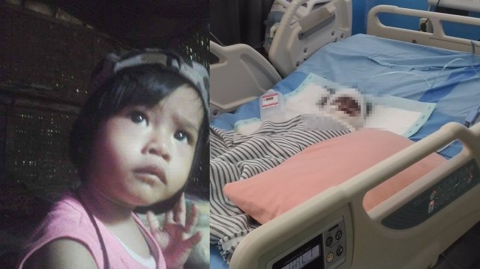 Ibu Lalai, Bayi Tewas setelah Tecebur ke Kuali Panas