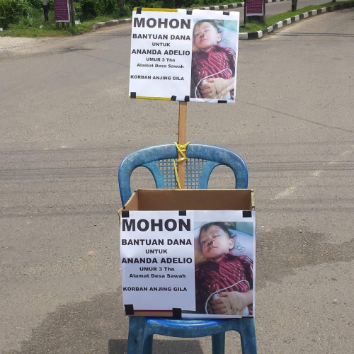 Balita di Kuansing Digigit Anjing Gila