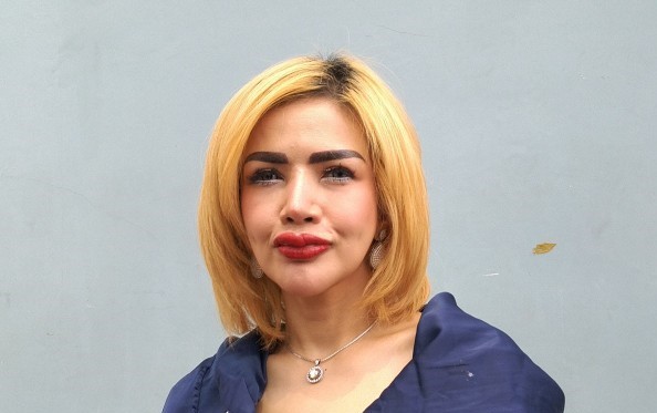 Bibir Barbie Kumala Sari Dower Setelah Dapat Endorsement