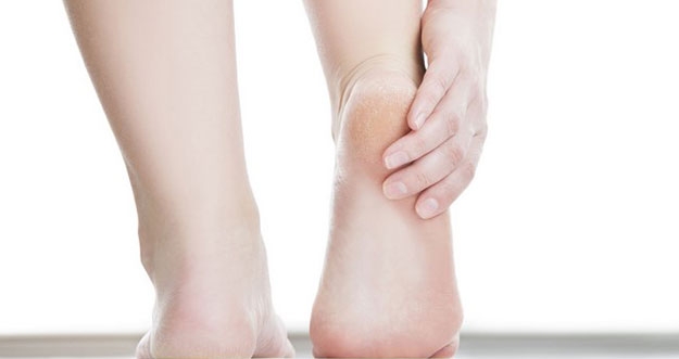 Atasi Tumit Kaki yang Pecah-pecah