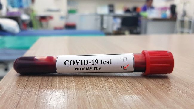 14 Napi di Rutan Siak Indrapura Masih Positif Covid-19