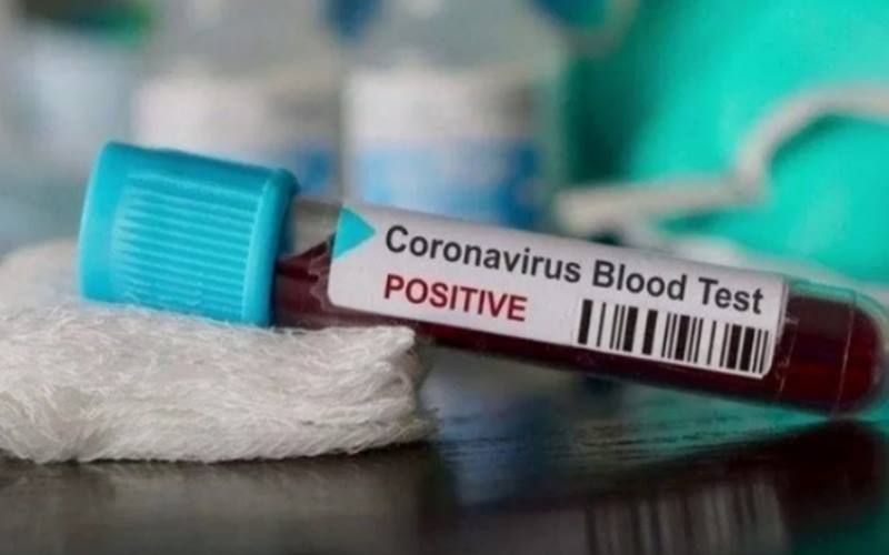 Satgas Riau: Positif Covid-19 Capai 5.000 Kasus 