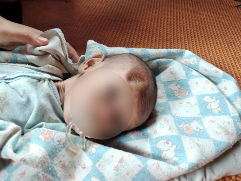 Dianiaya Ibu Kandung Kepala Bayi 4 Bulan di Tapanuli Selatan Penyok