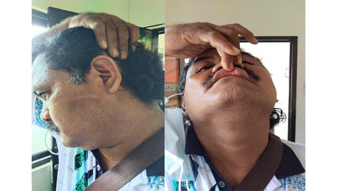 Tagih Utang, Warga Pelalawan Malah Dianiaya-Diancam Pakai Celurit 