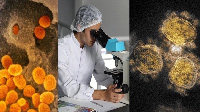 Gambar Virus Corona Diperbesar, Bentuk Corona seperti Mahkota