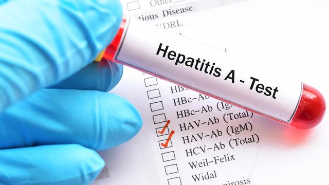 KLB Hepatitis A di Pacitan, Korban Nyaris Seribu Orang
