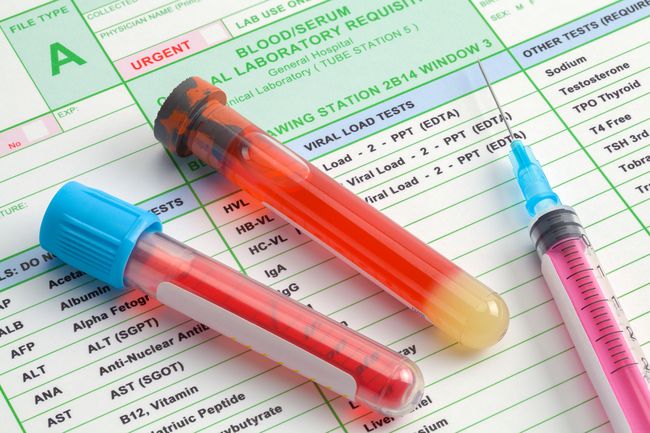 Eijkman Sudah Kirim 10 Sampel Virus Corona Pasien Indonesia 