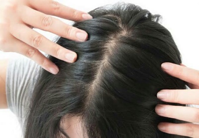 Gumpalan Rambut Seberat 19 Kg Diangkat dari Perut Remaja Ini 