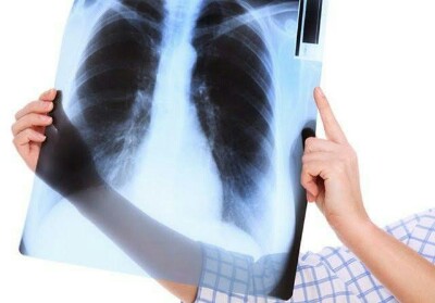 Bagi yang Mudik dengan Mobil, Dokter Paru Anjurkan Buka Kaca Setiap Satu Jam