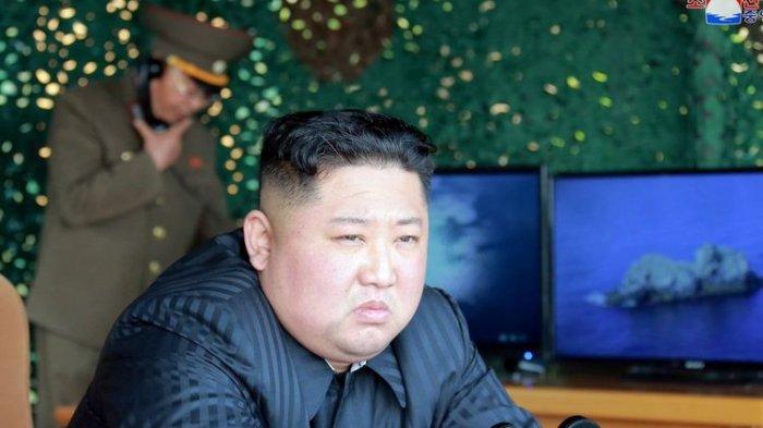 Pemimpin Korea Utara Kim Jong-un Dikabarkan Koma
